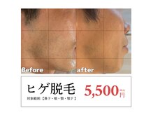 メンズエムボーテ 太田店(Men's M BEAUTE33)の雰囲気（施術BeforeAfterはブログやフォトギャラリーをご覧下さい♪）