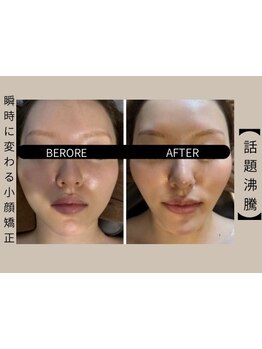 小顔になりたい