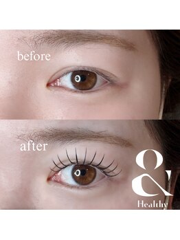 ジュノ(juno)の写真/マツエク×パーマ【＆healthy】導入店¥9000~/snsで話題!下がりまつげの方や瞼が被りやすい方もお悩み解決!