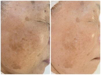 サラシック(salachic)/