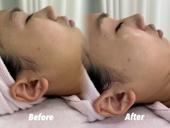 クイーン 渋谷店(QUEEN)/もみあげ周りもすっきり