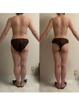 フェミニー(Feminy)/フェミニー痩身術