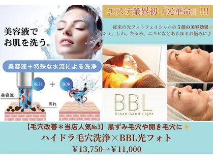 ベリッセ(Belisse)の写真