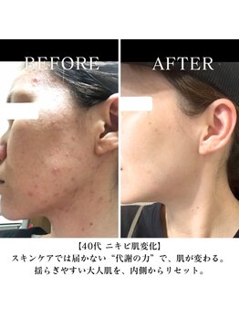 ヨサパーク インディゴ 都立大学(YOSA PARK Indigo)/肌荒れ改善・美肌効果にも◎