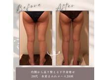 ヨサパーク ル フェルナ(YOSA PARK Le Ferna)