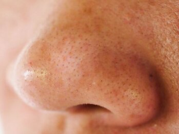 スカイアンドシー(sky&sea)の写真/「毛穴を隠すメイク」はもう卒業。最短で手に入れる滑らかな素肌感。結果重視、敏感肌で諦めてた方も大歓迎