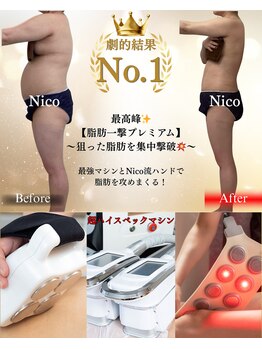 ニコ 岐南本店(Nico)の写真/【直接予約限定】一撃33万円がリニューアル！期間限定5.5万円で★気になる太ももやお尻にも効果絶大◎
