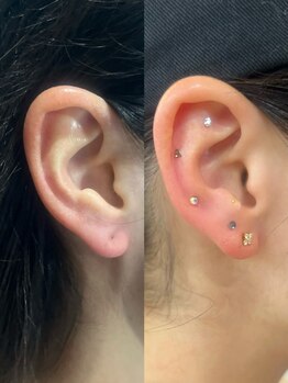 シロ(silo.)/耳ツボ