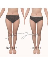 ブリリアントライフ(Blilyant life)/筋膜リリースでむくみ解消