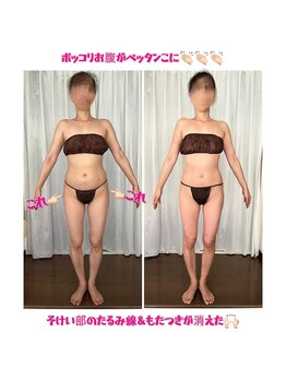 シュシュ エステティックアンドヨガ(chouchou esthetique&yoga)/がっつり脂肪3時間コース★3回