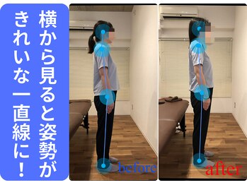 広島ミライエ整体院(広島MIRAIE整体院)/立ち姿勢が変わる