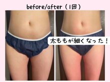 ヨサパーク ベアトリーチェ(YOSA PARK beatrice)/1回