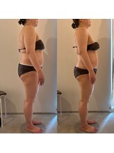 ラナ 京都西院店(Lana)/姿勢改善・浮腫み改善