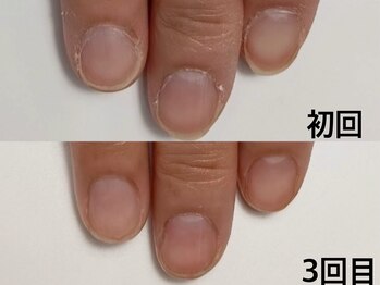 エヌ(N)/ネイリストMami限定