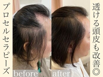 サロン アール(salon AR)/