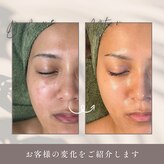 リーフィア(Leafia)