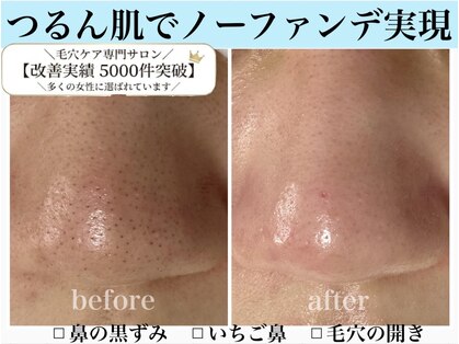 エミナル(eminal)の写真