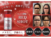 ブリランテ(Brillante)