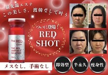 ブリランテ(Brillante)