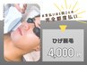 【新規限定★メンズ脱毛】まるっとヒゲ脱毛　¥4,000