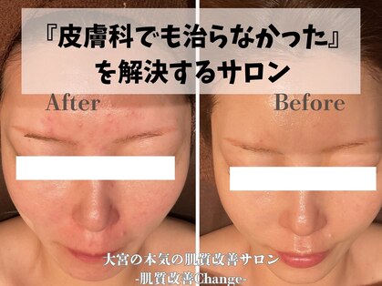 チェンジ(Change)の写真