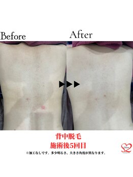 オリオンドットエスツー(Orion.S2)/【Before→After】