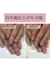 ティアラネイル(tiaranail)/再発させない深爪矯正