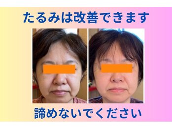 ねこのひげ/お客様の変化