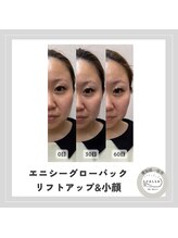 カラー(CALLA)/グローパック集中ケア！