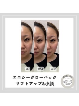 カラー(CALLA)/グローパック集中ケア！