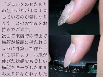 サロンエヌ(salon enu)/パラジェル深爪緩和クリアコース