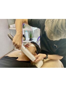 顔脱毛がしたい