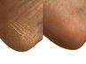 【フットケア/角質ケア】足裏全体のしっかりスペシャルケア〈60分〉