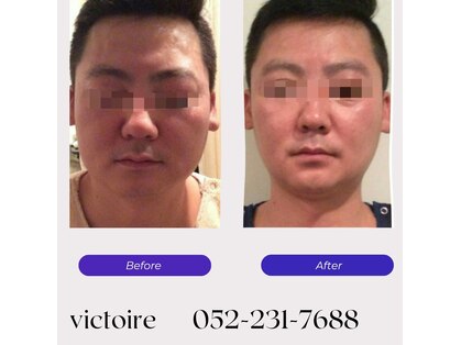 ヴィクトワール(Victoire)の写真
