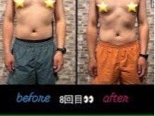 ビーワイ鍼灸整骨院 心斎橋院/before&after