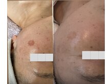 リュミエール(Lumie're)