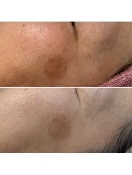 ソリシア(SORISIA)/