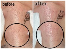 毛穴専科/毛穴洗浄+白玉ワックス メンズ◎