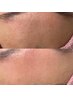 パックプレゼント〇フェイスwax＆幹細胞まつげパーマ ¥13000羊水幹細胞ケア