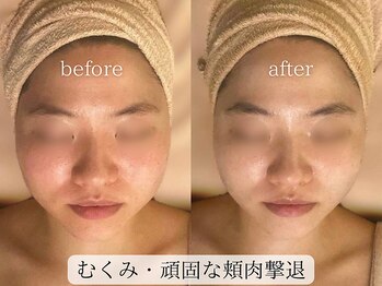 サロンハート(Salon Heart)/浦和エステ痩身/小顔/よもぎ蒸し