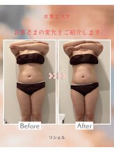 リシェル/ポッコリお腹☆ビフォーアフター