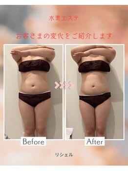 リシェル/ポッコリお腹☆ビフォーアフター