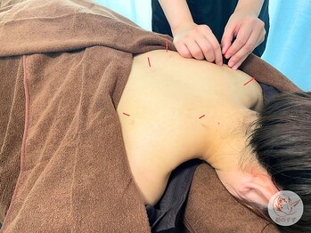 銀のすず 渋谷恵比寿院/【肩こり/腰痛】鍼灸マッサージ