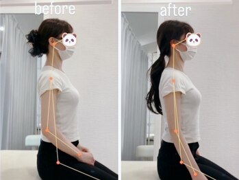 べっぷ餅ヶ浜整体院