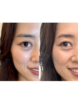 アイブロウメニューがあるサロン