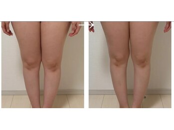 ソリ(soli)/before→after写真