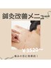 【痛みの芯に効果的!】初めての鍼灸改善メニュー ¥5720→¥3520