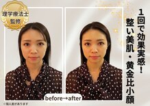 小顔美肌ファクトリー 梅田院