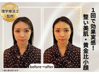 小顔美肌ファクトリー 梅田院の写真