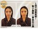 小顔美肌ファクトリー 梅田院の写真